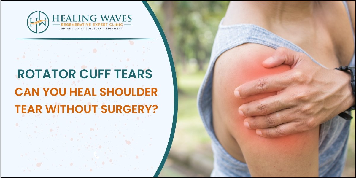 Rotator Cuff Tear Treatment Without Surgery